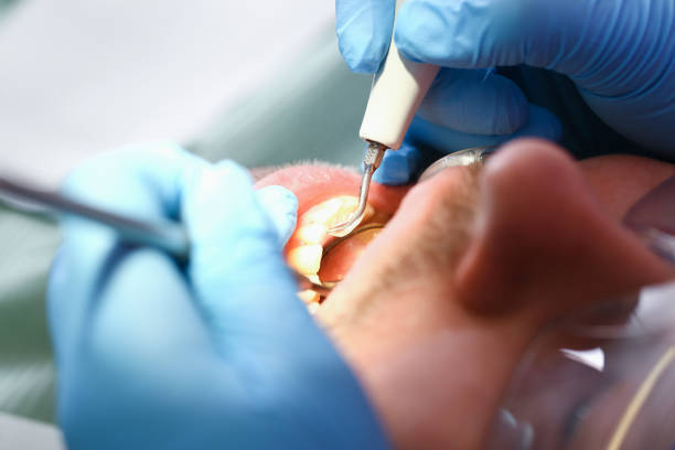 Best Tooth Infection Emergency Dentist  in Gardende, AL