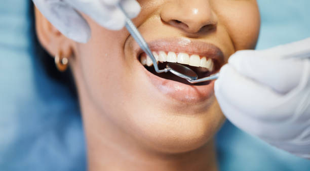 Best Root Canal Emergency Dentist  in Gardende, AL